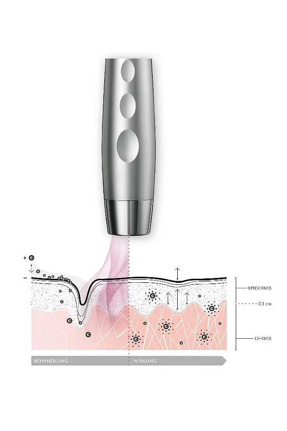 cell-Jet/Ultraschall Behandlung