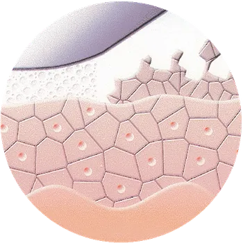 reviderm- Die Mikrodermabrasion trägt sanft und sicher die Hornzellen ab. 