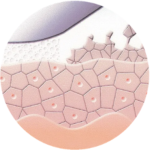 reviderm- Die Mikrodermabrasion trägt sanft und sicher die Hornzellen ab. 