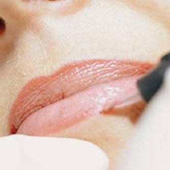 pigmentation-der-lippenkontur